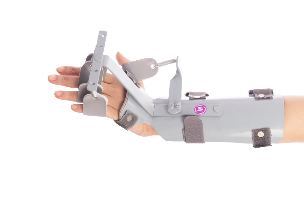 Dynamic Cock-Up Splint — view 1